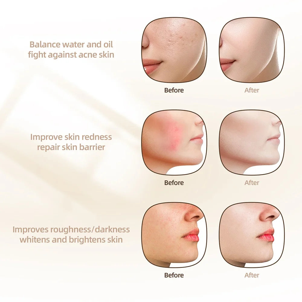 7-Color Photon Face LED Mask