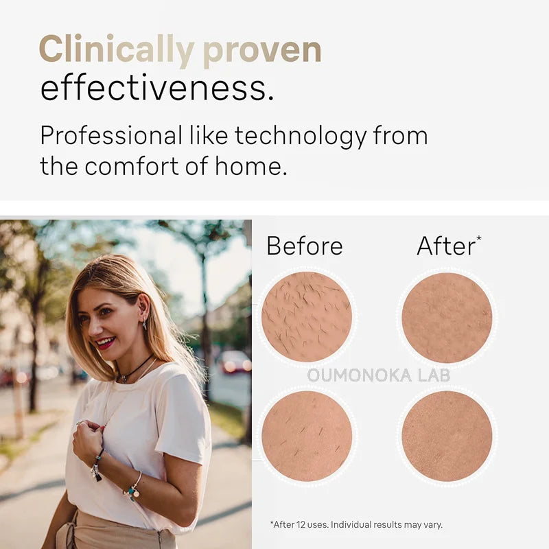 Wireless Freezing IPL Hair Removal Device