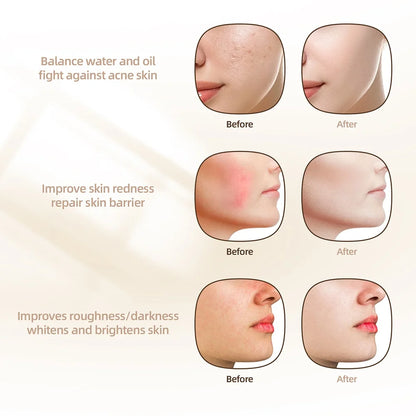 7-Color Photon Face LED Mask