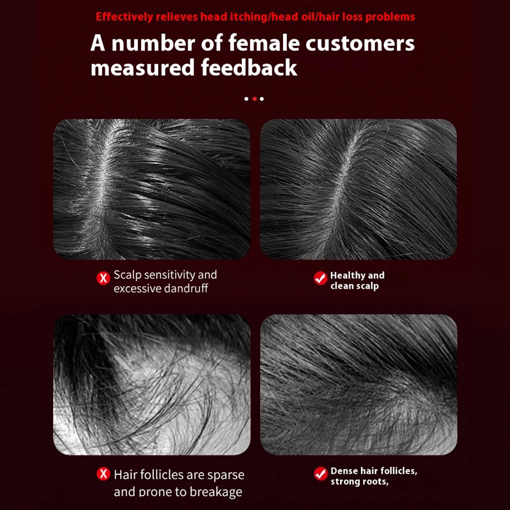 Electric Hair Care Scalp Comb