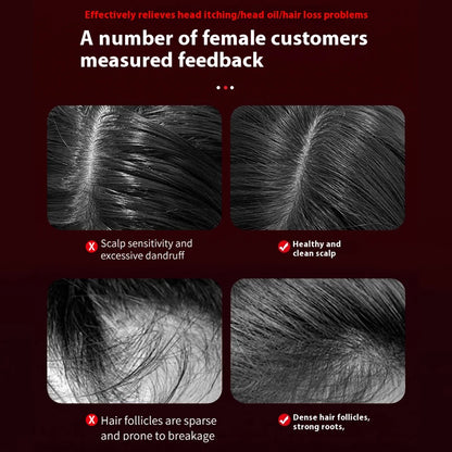 Electric Hair Care Scalp Comb