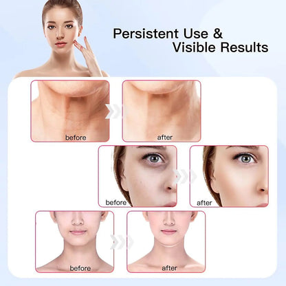 7-Color LED Face &amp; Neck Beauty Device